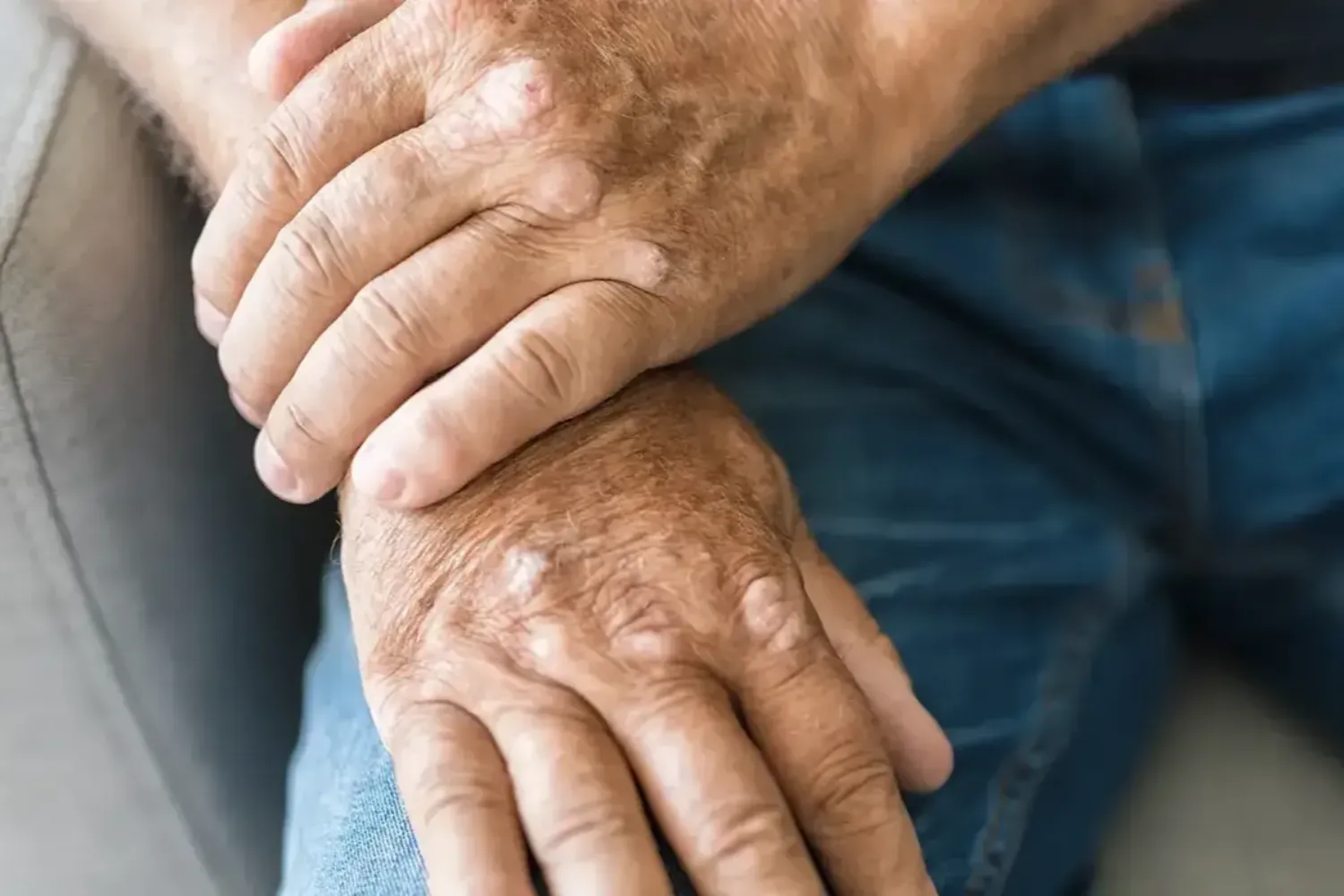 Knee arthritis relief